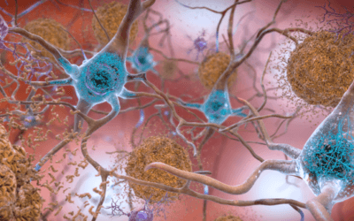 This brain protein may put the brakes on Alzheimer’s