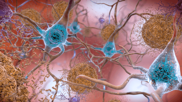 NYT: Why Didn’t She Get Alzheimer’s? The Answer Could Hold a Key to Fighting the Disease